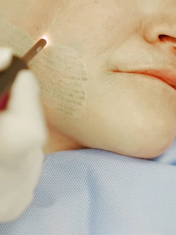 phi surgery